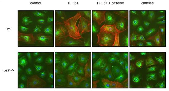 补充咖啡因能够促进TGFβ1诱导的心肌细胞分化