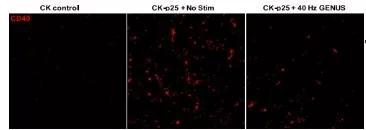 40Hz光照治疗减少了小鼠的CD40表达