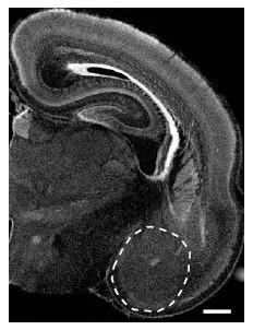  ▲在小鼠大脑切片上显示的杏仁核区域（虚线部位）。尽管这个脑区很小，它对情绪和社交行为非常重要（图片来源：参考资料[1]）