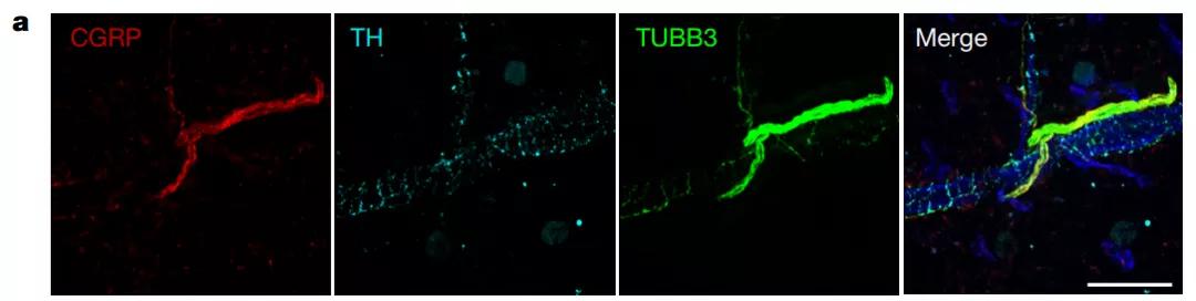 可见神经纤维中（TUBB3）由CGRP标记的伤害感受神经占了大多数