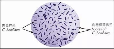 肉毒杆菌及孢子（图片来源：cfs.gov.hk）