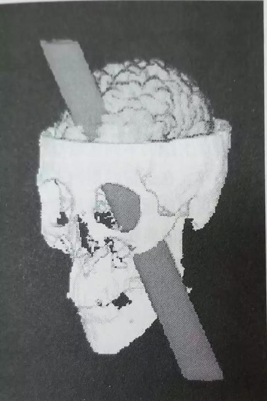 盖吉的头骨保存在哈佛大学医学院的沃伦解剖学博物馆