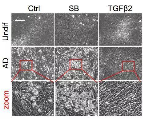 在衰老细胞模型中，加入SB表现出更明显的脂肪化形态，加入TGFβ的细胞表现为更加明显的纤维化形态