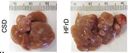 玉米淀粉组（CSD）和高果糖组（HFrD）小鼠肝脏肿瘤对比