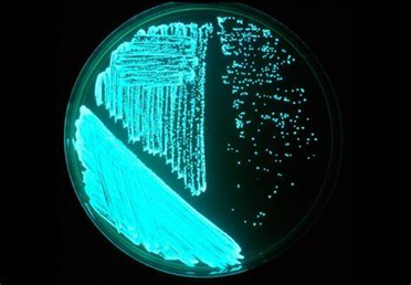  平板上发光的费氏弧菌（来源：微生物学第14版，2015）