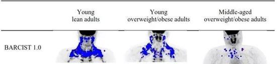 年轻的瘦子（左），年轻的超重者（中），以及中年超重者（右）体内棕色脂肪数量（蓝色）