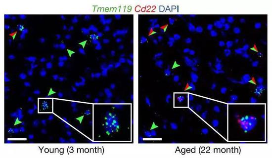 绿色：小胶质细胞；红色：CD22 红绿箭头为表达了CD22的小胶质细胞