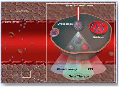 图2 光热疗法治疗肿瘤细胞（图片来自网络）