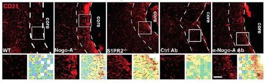 ▲阻断Nogo-A通路后，缺血边缘区的血管生长显著增强（图片来源：参考资料[1]）