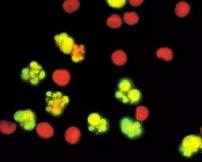 凋亡的细胞（图片来源：http://refer.biovip.com）