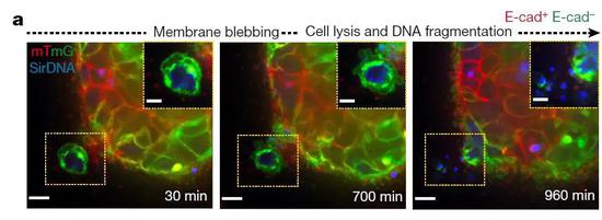 ▲缺乏E-cadherin蛋白的癌细胞（黄色方框内）会出现细胞凋亡（图片来源：参考资料[1]）