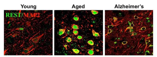 ▲REST在正常老化大脑的神经元中被诱导表达（图片来源：参考资料[4]）