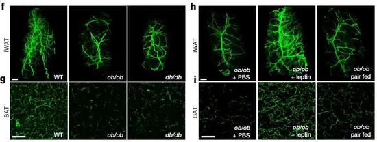 左边一组图显示，在瘦素不足（ob/ob）的小鼠体内，支配脂肪的神经发生萎缩；右边一组图显示，注射瘦素两周后，两类脂肪组织中的交感神经重新生长