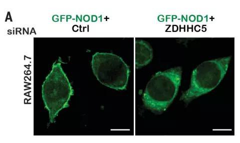 ▲抑制ZDHHC5蛋白的表达，就会影响NOD1蛋白的定位（图片来源：参考资料[1]）