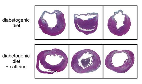 可见补充了咖啡因的小鼠（下）心肌壁明显更健康