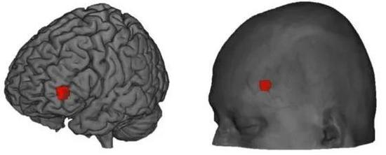 ▲红色所示部位左前额叶外侧皮质（图片来源：参考资料[1]）