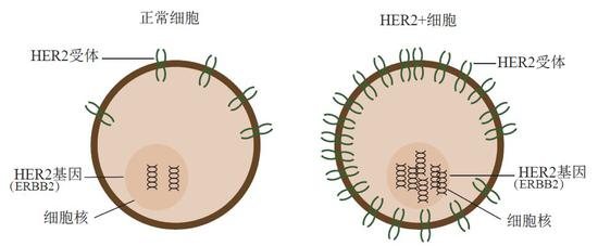 针对乳腺癌的新型靶向药帕捷特在中国获批上市癌细胞赫赛汀乳腺癌