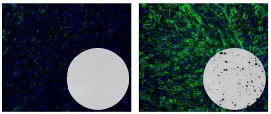 ▲与对照组（左）相比，治疗组的抗肌萎缩蛋白水平（绿色）在一年后依旧保持在高位，但体内对基因疗法产生了一定的免疫反应（灰色圆形视野中，黑色小点为聚集的免疫T细胞）（图片来源：Charles Gersbach，Duke University）
