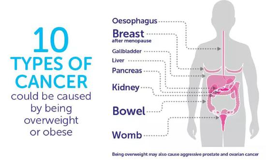 肥胖与多种癌症相关