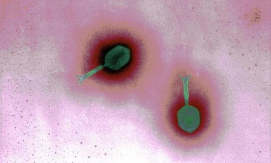 经过后期上色的T4噬菌体。图片来源：Gregory & Marshall/Wellcome Collection