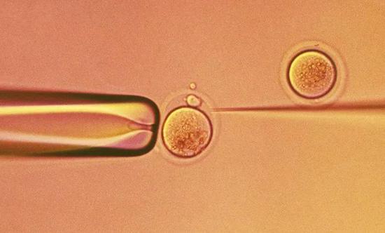 图为体外受精的人类卵子。　来源：CC Studio/SPL