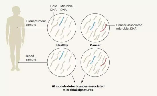 组织和血液中的微生物 DNA