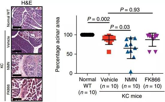 补充NMN降低了正常腺泡的面积，FK866是NAMPT的抑制剂