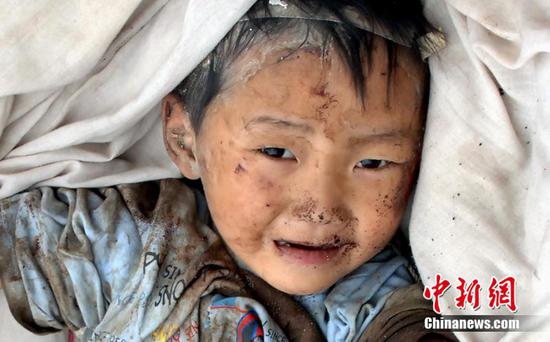2008年5月14日，在汶川地震中受伤的儿童。中新社记者 邹宪摄