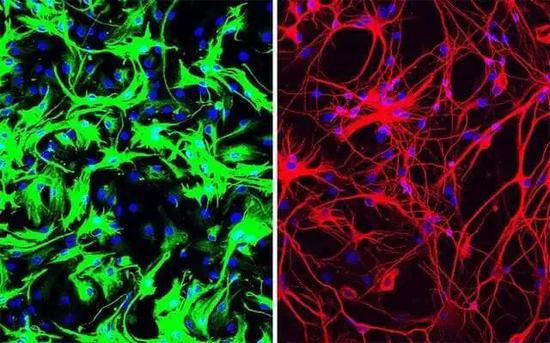 通过反义寡核苷酸，小鼠的星形胶质细胞（绿色）被诱导成为神经元（红色）| UC San Diego Health Sciences