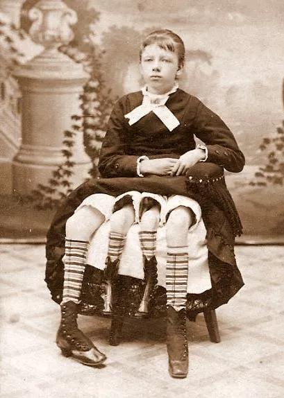 默特尔·科尔宾(myrtle corbin,这个长着四条腿的女人是杂耍节目明星