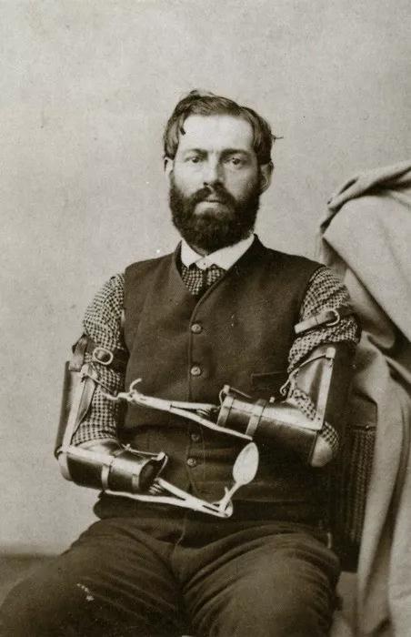 内战老兵Samuel Decker自制的假肢，19世纪60年代。图源：Pinterest