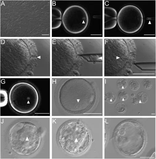 通过SCNT技术，使用胎儿猴的成纤维细胞培育克隆猴的过程。图片来源：Cell， Liu et al。， 2018 A：科学家培养的胎儿猴的成纤维细胞。 B和C：猴子卵细胞中的纺锤体—染色体复合物（箭头位置）被移除。 D：通过激光辐射，在卵子的透明带（箭头位置）上制造一条裂缝。 F：经过灭活仙台病毒（HVJ-E）处理过的成纤维细胞（箭头位置）被注射到卵黄周隙。 G：成纤维细胞与卵细胞的细胞质融合后，在前者的细胞核的作用下，卵子内形成了类似纺锤体的结构。 H：用离子霉素和DMAP（4-二甲氨基吡啶）活化重建卵母细胞。所有活化的胚胎显示单原核（箭头位置）。 I：把Kdm4d-mRNA注入胚胎后，胚胎逐渐发育成囊胚（箭头所指为内细胞团，ICM） J-L：ICM正常和不正常发育的囊胚的对比图。
