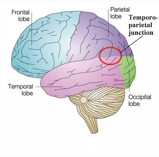 睡眠瘫痪:睡眠瘫痪是否真的有救?超自然现象应如何解释 图源:MIND