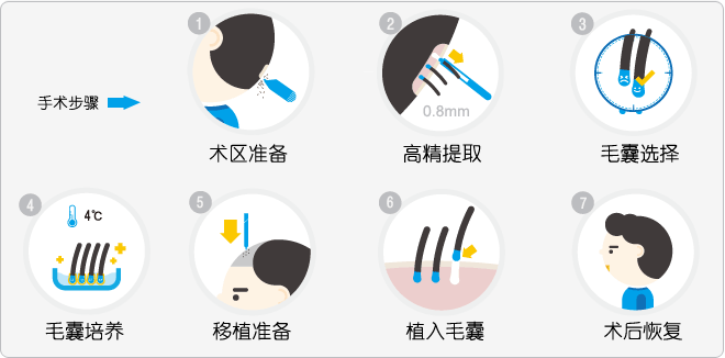 ▲ 植发手术。 图片来自:每日頭條