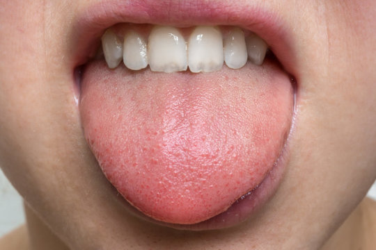 鼻子中能够探测气味、具有嗅觉功能的感受器也存在于舌头上的味觉细胞中