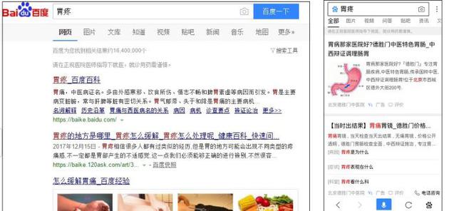 (左右图分别为电脑端和手机端“胃疼”关键词搜索结果)
