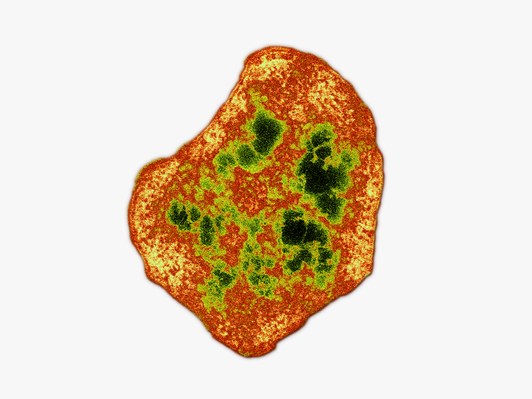 如果土卫二上潜藏着生命，那它们很可能与冲绳甲烷球菌（学名：Methanothermococcus okinawensis）非常接近。