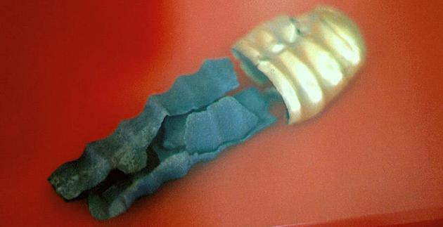 来自小亚细亚的一种罕见的龟头避孕套，制造于青铜时代，用金和银制成