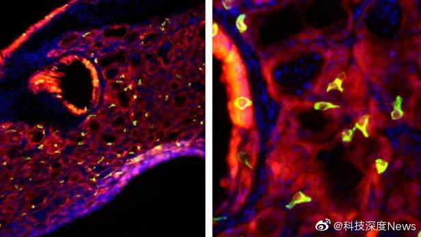 有科学研究小组发现,严重流感可能导致肺部长出“味蕾细胞”