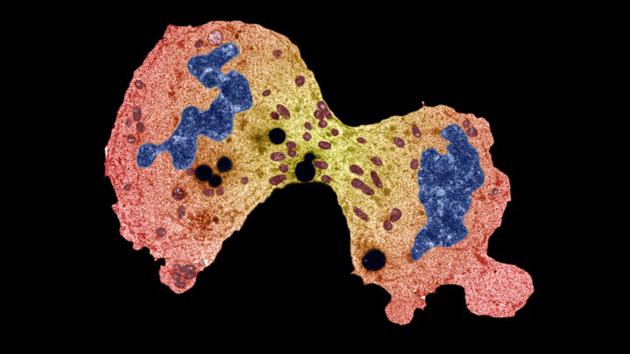 图中是一个细胞分裂成两个细胞，DNA是图中蓝色部分。科学家最新研究显示，LINE1基因在人类基因中重复50万次，差不多占到每个细胞的五分之一。