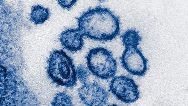通过电子显微镜成像的SARS-CoV-2病毒。资料来源：美国国立卫生研究院