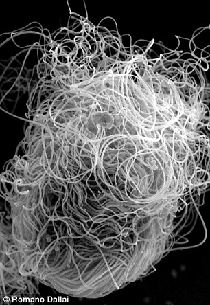 二裂果蝇的精子。尽管卷成一团，但科学家还是对其长度进行了测量，发现伸开时长度可达5.8厘米，是二裂果蝇体长的20倍以上。