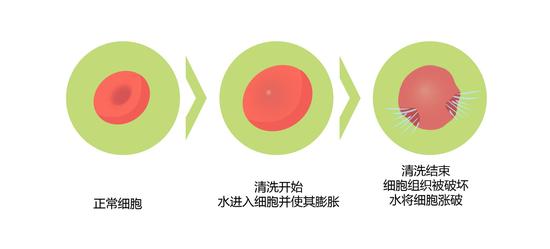 被泼硫酸怎么办?如何应对酸碱等化学灼伤 传统水冲洗办法(绘图 肖媛)