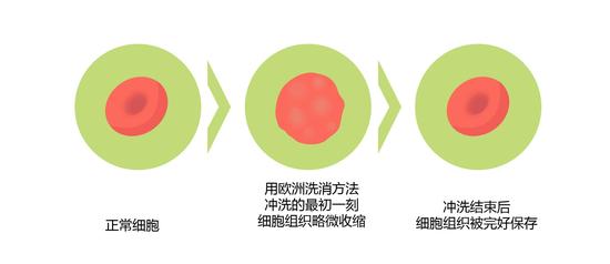 被泼硫酸怎么办?如何应对酸碱等化学灼伤 用欧洲洗消方法冲洗的最初一刻,细胞组织略微收缩,及冲洗结束后,细胞组织被完好保存。(绘图 肖媛)