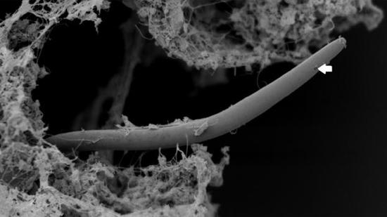 一只学名为Monhystrella parvella的线虫