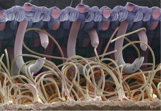 维可牢的扫描电镜图片展现了它与牛蒡钩刺的相似性。图片来源:Science Photo Library
