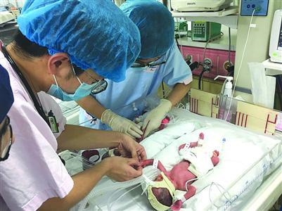 皇室4胞胎:上海诞生同卵四胞胎姐妹:将来一模一样