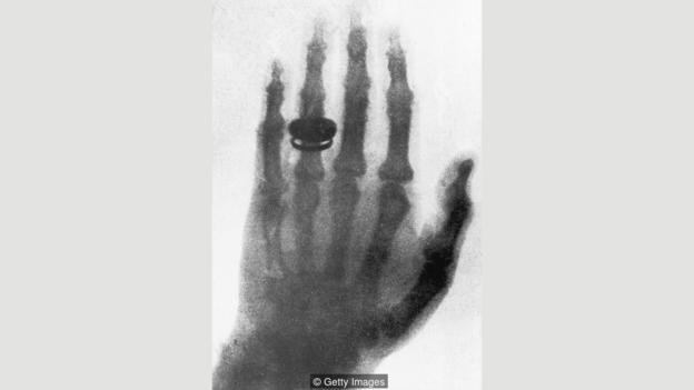 1895年,人类发现X射线的消息吸引了全世界的注意
