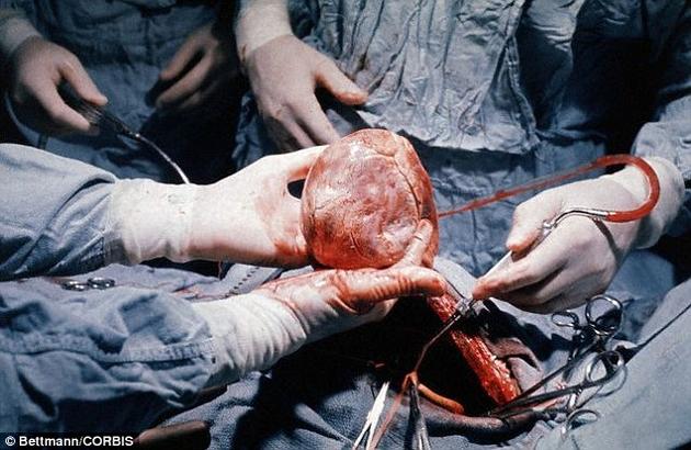 2014年，英国有429名病人由于缺少合适的器官捐献者而死。美国科学家已经开展了人兽混合胚胎实验，希望能在猪和绵羊体内培植出人类器官。