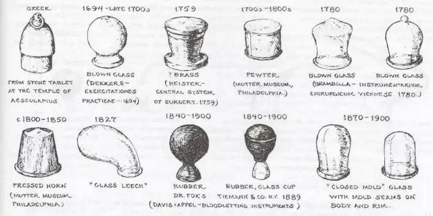 各式各样的西方吸杯(Antique Medical Instruments, C. K. Wilbur, Lancaster: Schiffer Publishing Ltd. U.S.A, 2003, 5th edition，117)